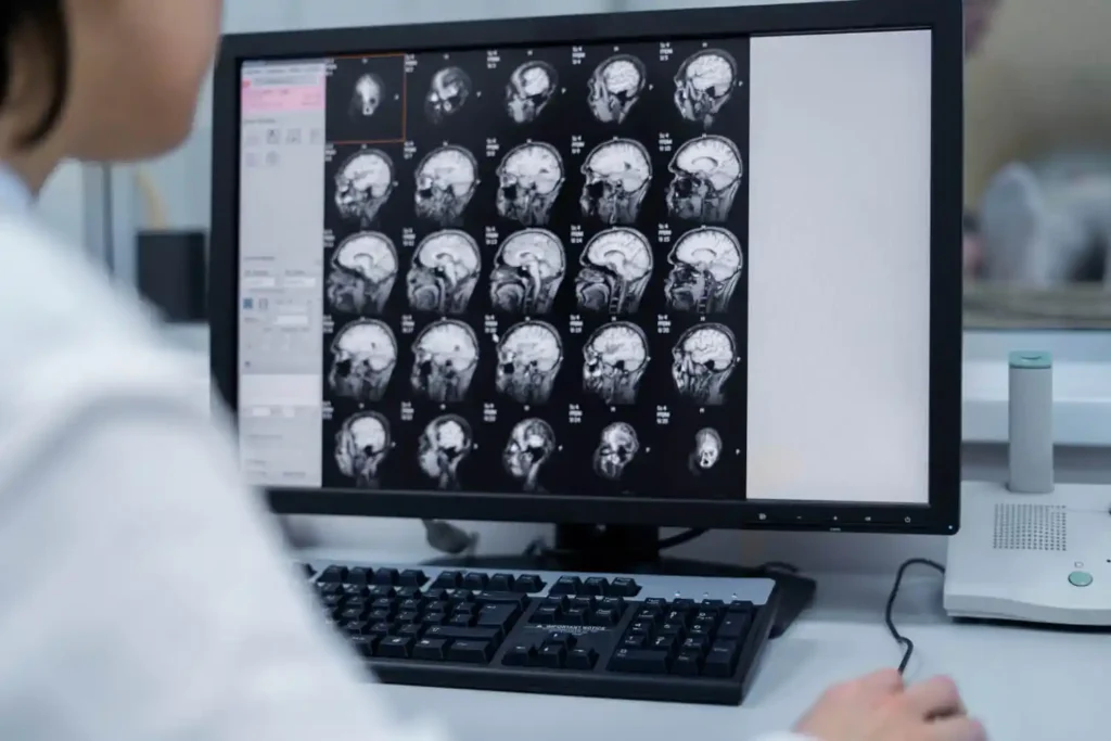 Imagenología del cerebro. Foto: Freepik